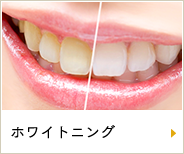 ホワイトニング