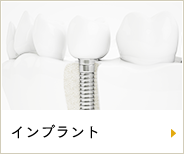 インプラント