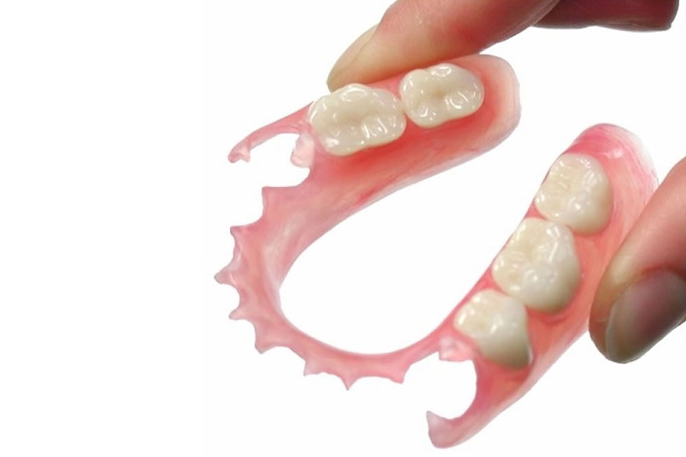 金属を使わないスマイルデンチャー