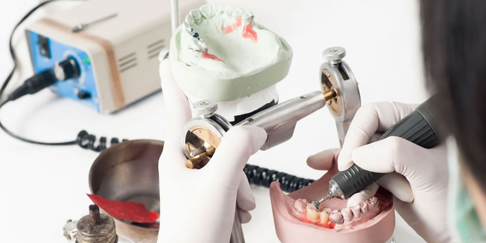 最優秀歯科技工士