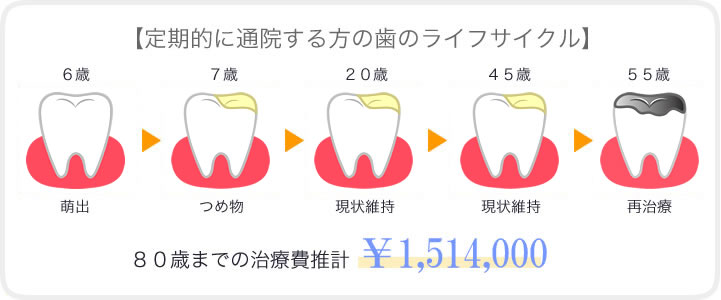 予防に取り組む人と痛い時にだけ治療する人の歯の寿命・治療費の比較