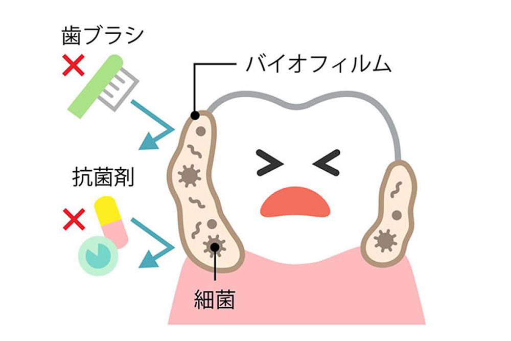 バイオフィルム