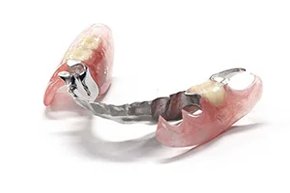 コンフォート義歯