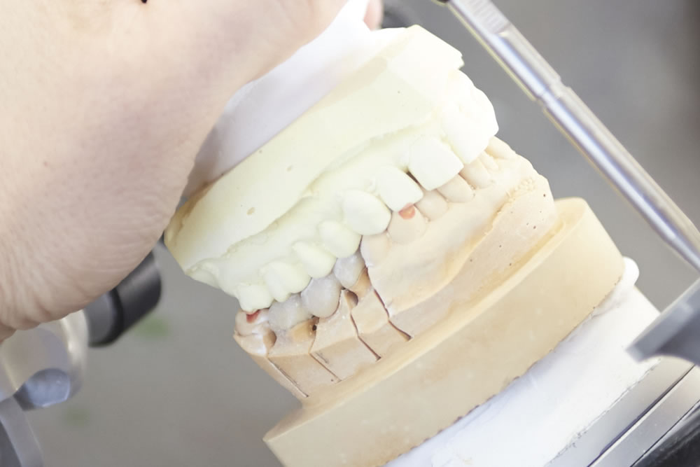 入れ歯・義歯の調整